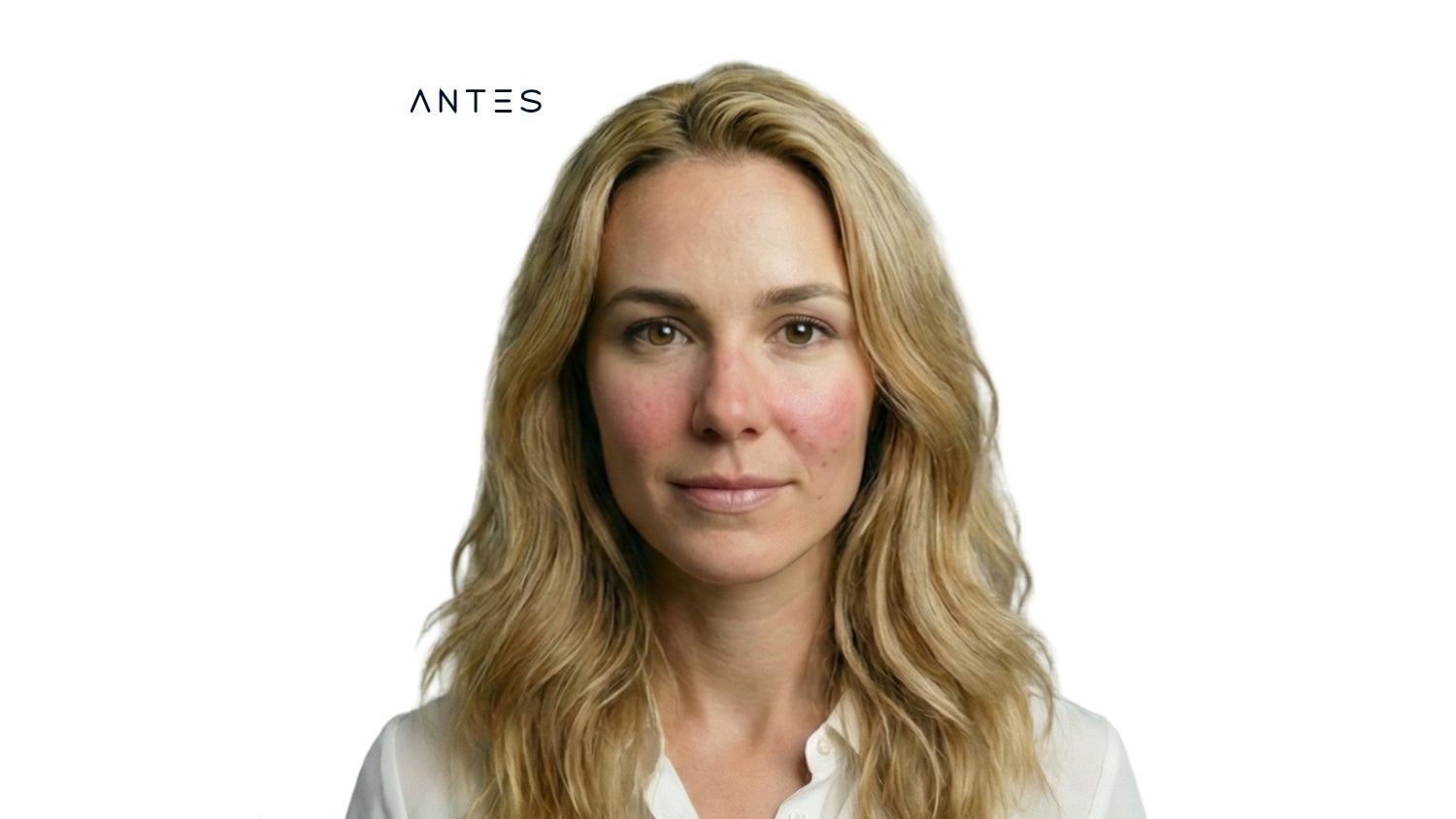 Antes